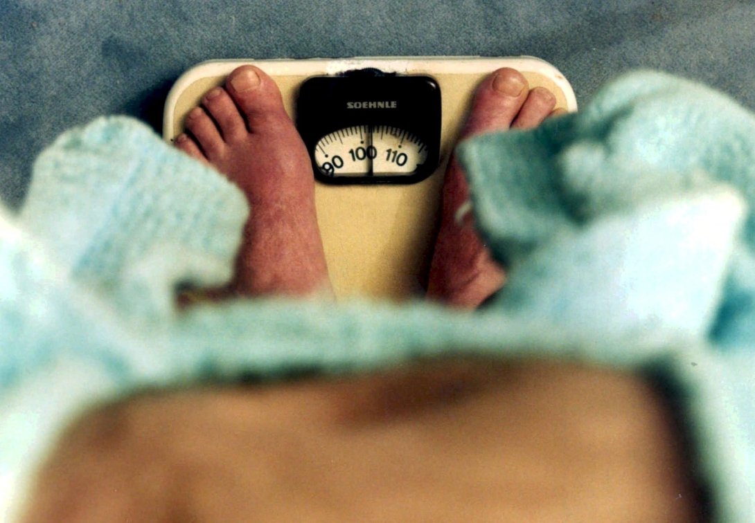 „Lieber sterben, als zunehmen“ – Der verzweifelte Kampf bei Magersucht